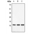 LifeSab™ Histone H3 (DiMethyl K9) Rabbit pAb (50 µl)