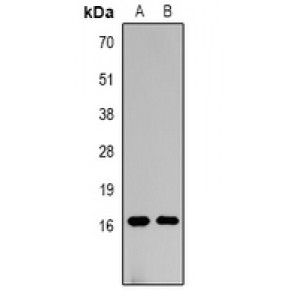 LifeSab™ Histone H3 (MonoMethyl K36) Rabbit pAb (50 µl)