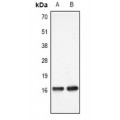 LifeSab™ Histone H3 (MonoMethyl K4) Rabbit pAb (50 µl)