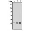 LifeSab™ Histone H3 (MonoMethyl K9) Rabbit pAb (50 µl)