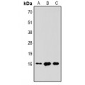 LifeSab™ Histone H3 (TriMethyl K79) Rabbit pAb (50 µl)