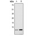 LifeSab™ Histone H4 (DiMethyl K79) Rabbit pAb (50 µl)