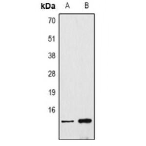 LifeSab™ Histone H4 (DiMethyl K79) Rabbit pAb (50 µl)