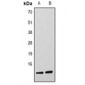LifeSab™ Histone H4 (MonoMethyl K79) Rabbit pAb (50 µl)