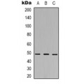 LifeSab™ NMBR Rabbit pAb (50 µl)