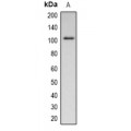 LifeSab™ Peroxiredoxin 1 Rabbit pAb (50 µl)