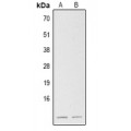 LifeSab™ SLC12A4 Rabbit pAb (50 µl)