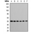 LifeSab™ SOD1 Rabbit pAb (50 µl)