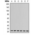 LifeSab™ STAT2 Rabbit pAb (50 µl)