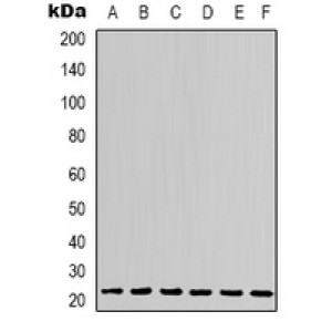 LifeSab™ STAT2 Rabbit pAb (50 µl)