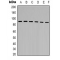 LifeSab™ TBP Rabbit pAb (50 µl)