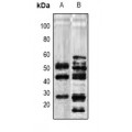 LifeSab™ Transferrin Rabbit pAb (50 µl)