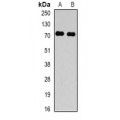 LifeSab™ TBRG4 Rabbit pAb (50 µl)