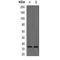 LifeSab™ TPMT Rabbit pAb (50 µl)