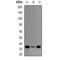 LifeSab™ HADH Rabbit pAb (50 µl)