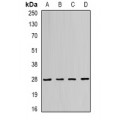 LifeSab™ RAB11A Rabbit pAb (50 µl)