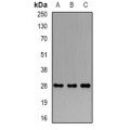 LifeSab™ PRDX4 Rabbit pAb (50 µl)