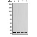 LifeSab™ DHFR Rabbit pAb (50 µl)