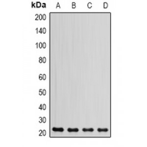 LifeSab™ DHFR Rabbit pAb (50 µl)