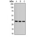 LifeSab™ ANT1 Rabbit pAb (50 µl)