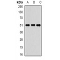 LifeSab™ Reptin 52 Rabbit pAb (50 µl)