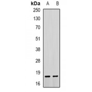 LifeSab™ Troponin C Rabbit pAb (50 µl)