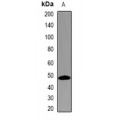 LifeSab™ TMPRSS2 Rabbit pAb (50 µl)