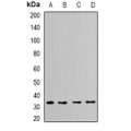 LifeSab™ CapZ alpha-2 Rabbit pAb (50 µl)