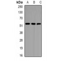 LifeSab™ EPHX1 Rabbit pAb (50 µl)