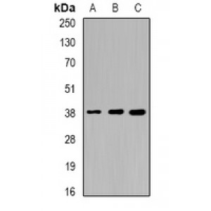 LifeSab™ Sorbitol Dehydrogenase Rabbit pAb (50 µl)