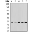 LifeSab™ UQCRC2 Rabbit pAb (50 µl)