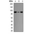 LifeSab™ CPT1A Rabbit pAb (50 µl)