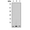 LifeSab™ GHRH Rabbit pAb (50 µl)