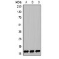 LifeSab™ NPC2 Rabbit pAb (50 µl)