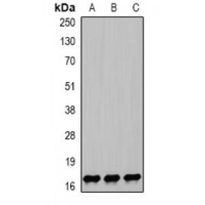 LifeSab™ NPC2 Rabbit pAb (50 µl)