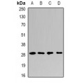LifeSab™ PSMF1 Rabbit pAb (50 µl)