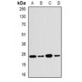 LifeSab™ PA28 beta Rabbit pAb (50 µl)