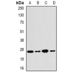 LifeSab™ PA28 beta Rabbit pAb (50 µl)