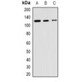 LifeSab™ SKIV2L2 Rabbit pAb (50 µl)