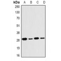 LifeSab™ PSMB4 Rabbit pAb (50 µl)