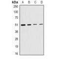 LifeSab™ Citrate Synthase Rabbit pAb (50 µl)