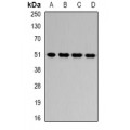 LifeSab™ HADHB Rabbit pAb (50 µl)