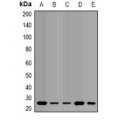 LifeSab™ QDPR Rabbit pAb (50 µl)