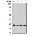 LifeSab™ PSMA5 Rabbit pAb (50 µl)