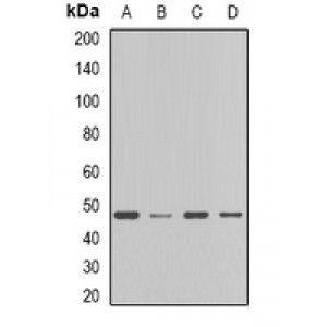 LifeSab™ FDFT1 Rabbit pAb (50 µl)