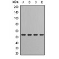 LifeSab™ IRF-6 Rabbit pAb (50 µl)