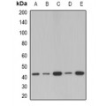 LifeSab™ SerpinB1 Rabbit pAb (50 µl)