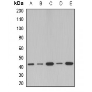 LifeSab™ SerpinB1 Rabbit pAb (50 µl)