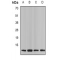 LifeSab™ Neurokinin B Rabbit pAb (50 µl)