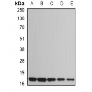 LifeSab™ UBE2B Rabbit pAb (50 µl)